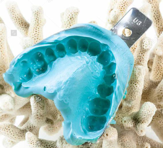 藻酸鹽齒科印模材料應(yīng)用