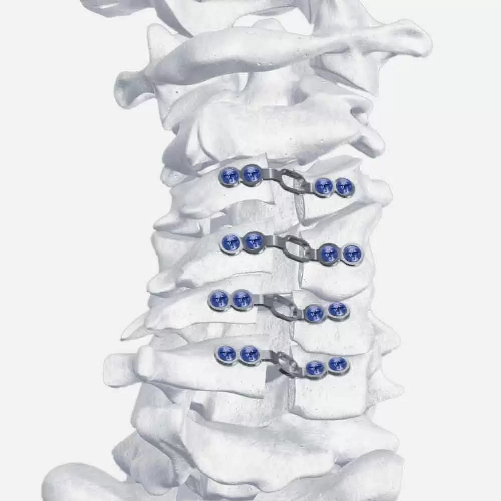 Surgical Instruments