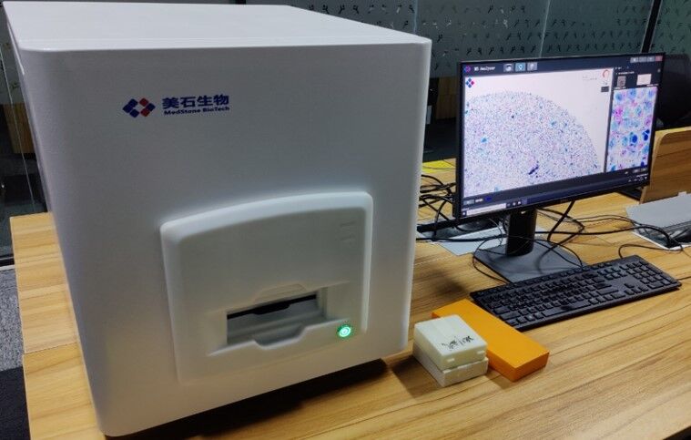 宫颈癌智能分析仪