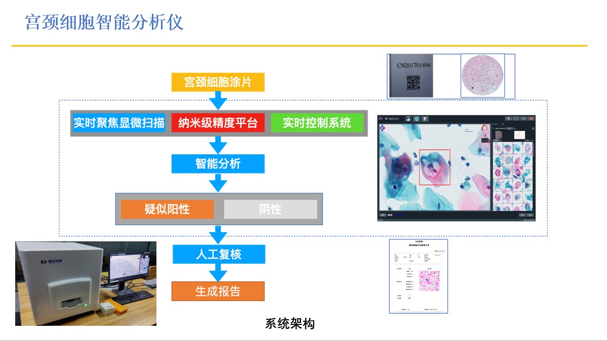 宫颈癌分析仪-1.png