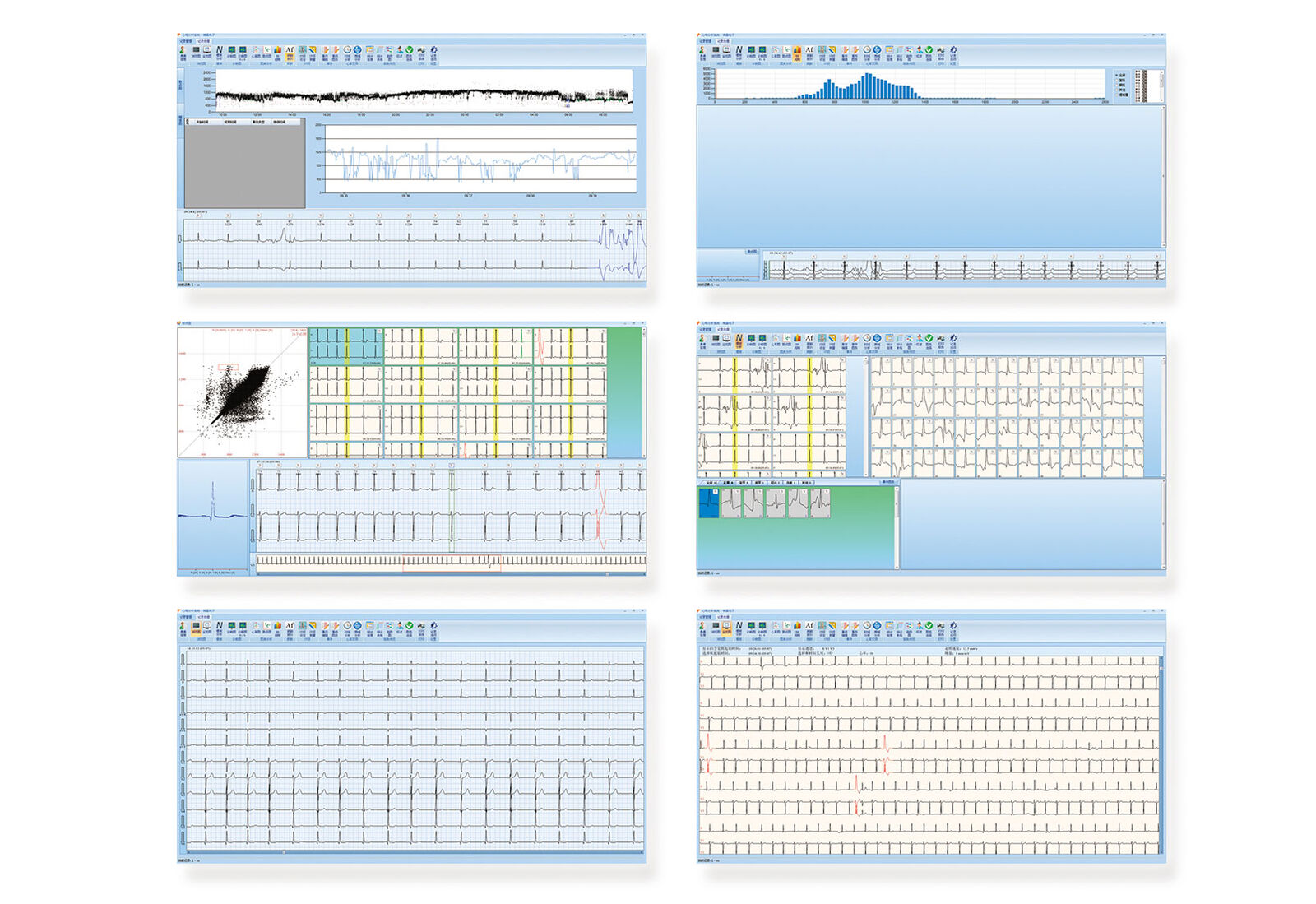 EXC-60A 动态心电分析系统