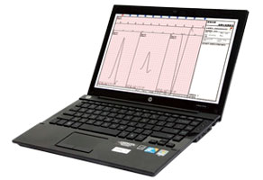 EXC-70D12 电脑化心电图机