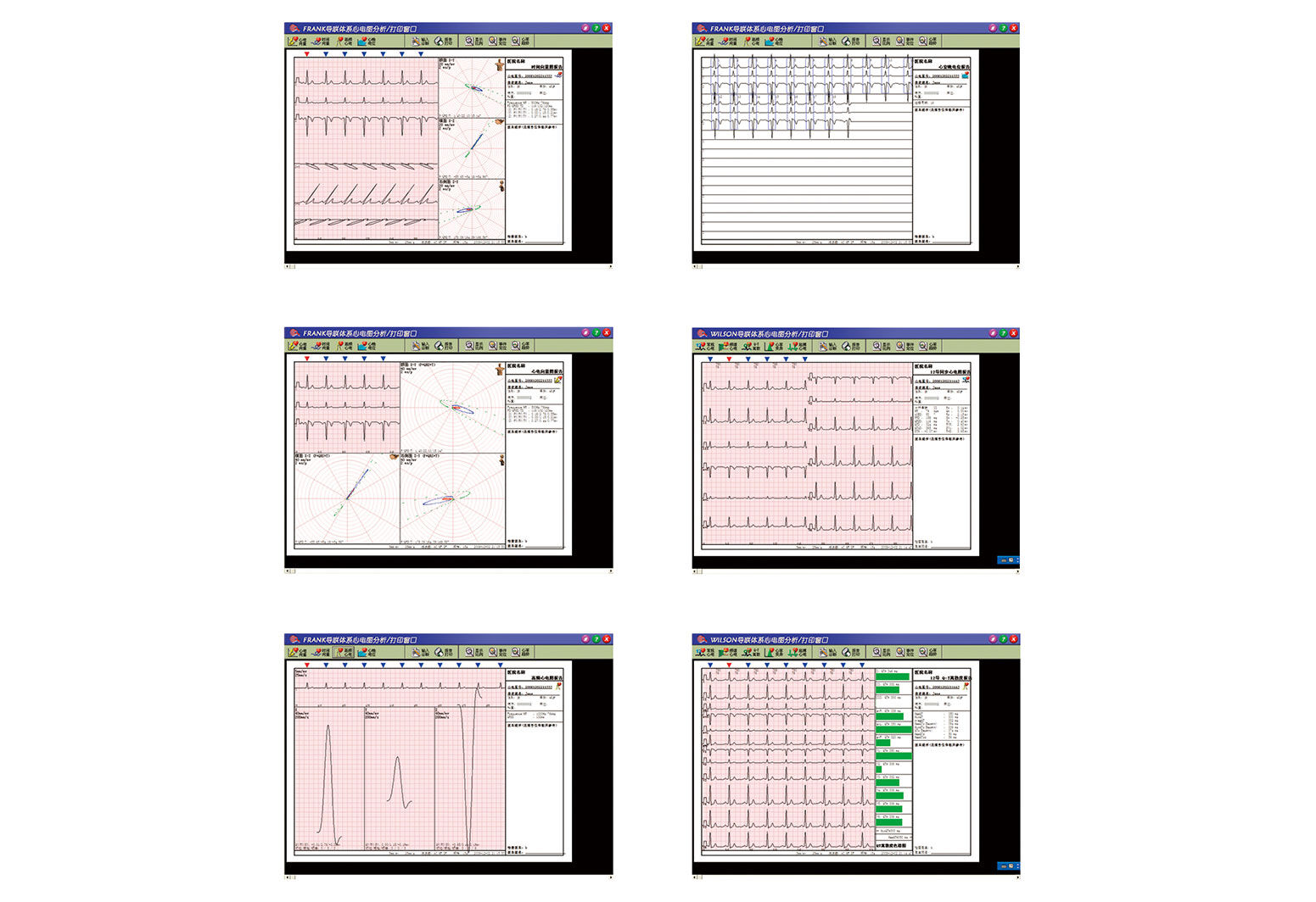 EXC-70D12 电脑化心电图机