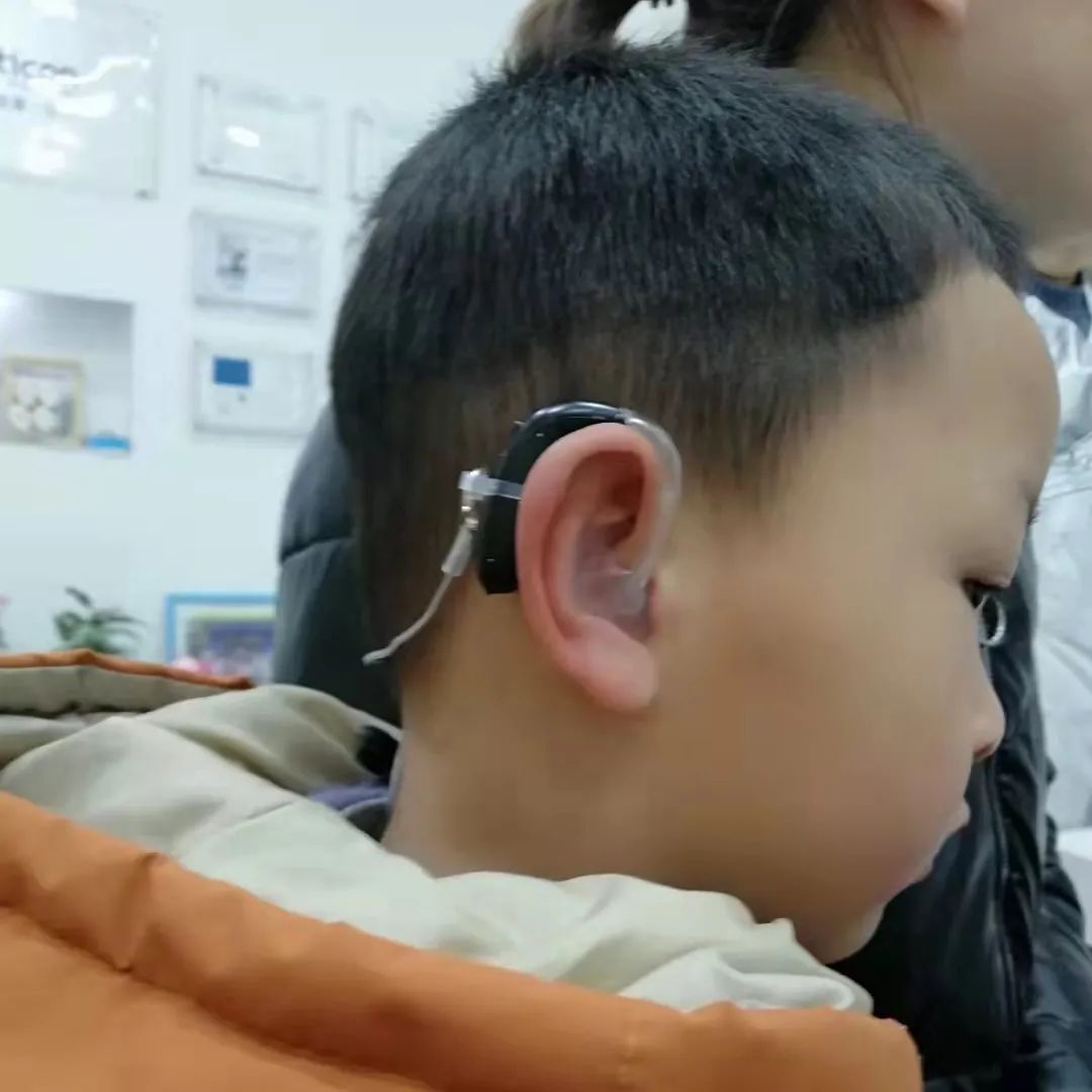 极重度感音神经性耳聋，可以植入人工耳蜗吗？