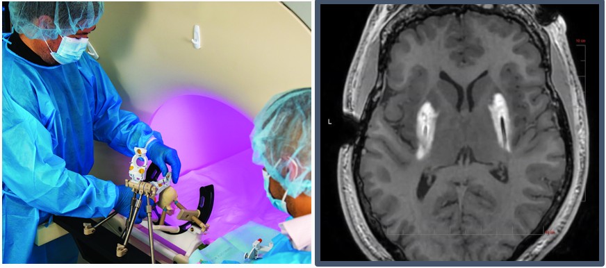 640?wx_fmt=png&tp=wxpic&wxfrom=5&wx_lazy=1&wx_co=1