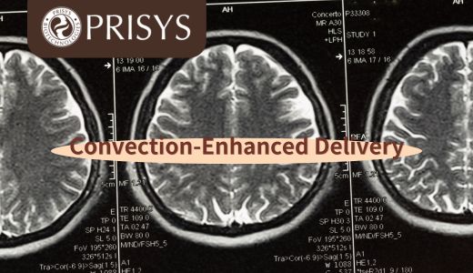 浦灵生物 | 对流增强给药技术