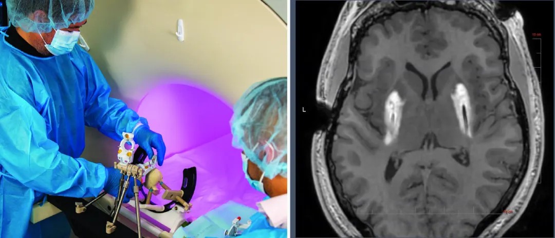 640?wx_fmt=png&from=appmsg&tp=webp&wxfrom=5&wx_lazy=1&wx_co=1 640?wx_fmt=png&from=appmsg&tp=webp&wxfrom=5&wx_lazy=1&wx_co=1