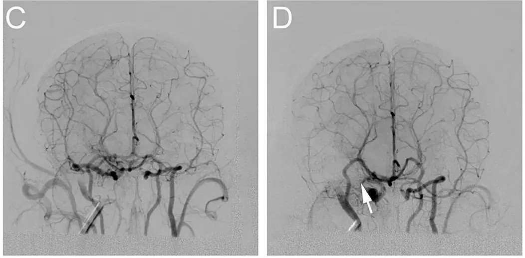 640?wx_fmt=jpeg&tp=webp&wxfrom=10005&wx_lazy=1&wx_co=1