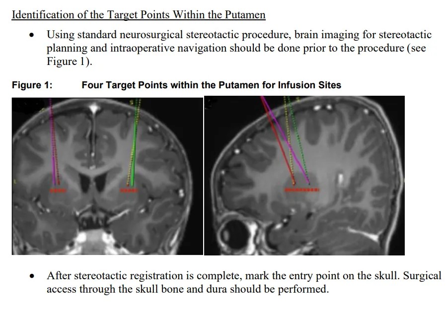 640?wx_fmt=png&tp=webp&wxfrom=10005&wx_lazy=1&wx_co=1
