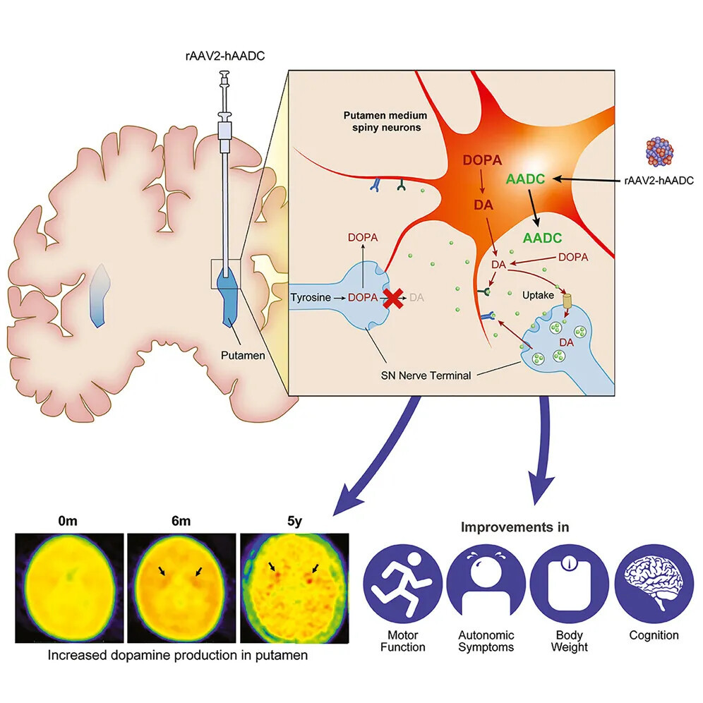640?wx_fmt=jpeg&tp=webp&wxfrom=10005&wx_lazy=1&wx_co=1