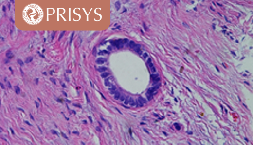 浦灵生物食蟹猴子宫内膜异位症模型