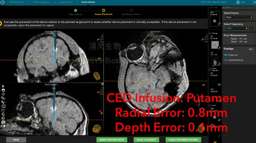 640?wx_fmt=png&from=appmsg&tp=webp&wxfrom=10005&wx_lazy=1 640?wx_fmt=png&from=appmsg&tp=webp&wxfrom=10005&wx_lazy=1