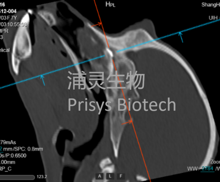 浦灵生物非人灵长类（NHP）经鼻到脑（N2B）给药技术平台