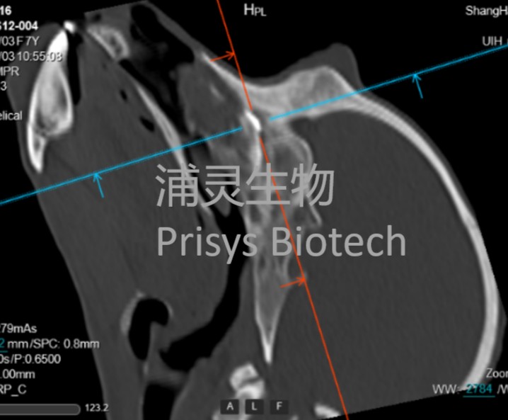 640?wx_fmt=png&from=appmsg&tp=wxpic&wxfrom=10005&wx_lazy=1#imgIndex=1 640?wx_fmt=png&from=appmsg&tp=wxpic&wxfrom=10005&wx_lazy=1#imgIndex=1