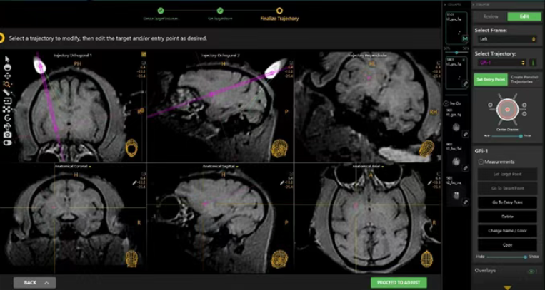 浦灵生物MRI引导脑定位给药平台｜中枢神经系统新药研发的精准解决方案