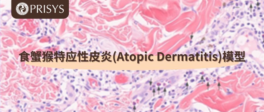 食蟹猴特应性皮炎(Atopic Dermatitis)模型 食蟹猴特应性皮炎(Atopic Dermatitis)模型