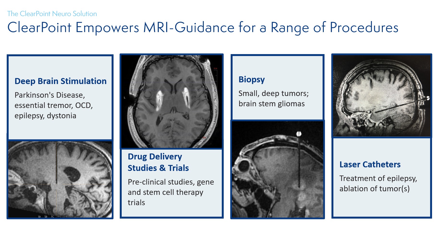 基于术中MRI（iMRI）引导的非人灵长类脑内精准给药平台