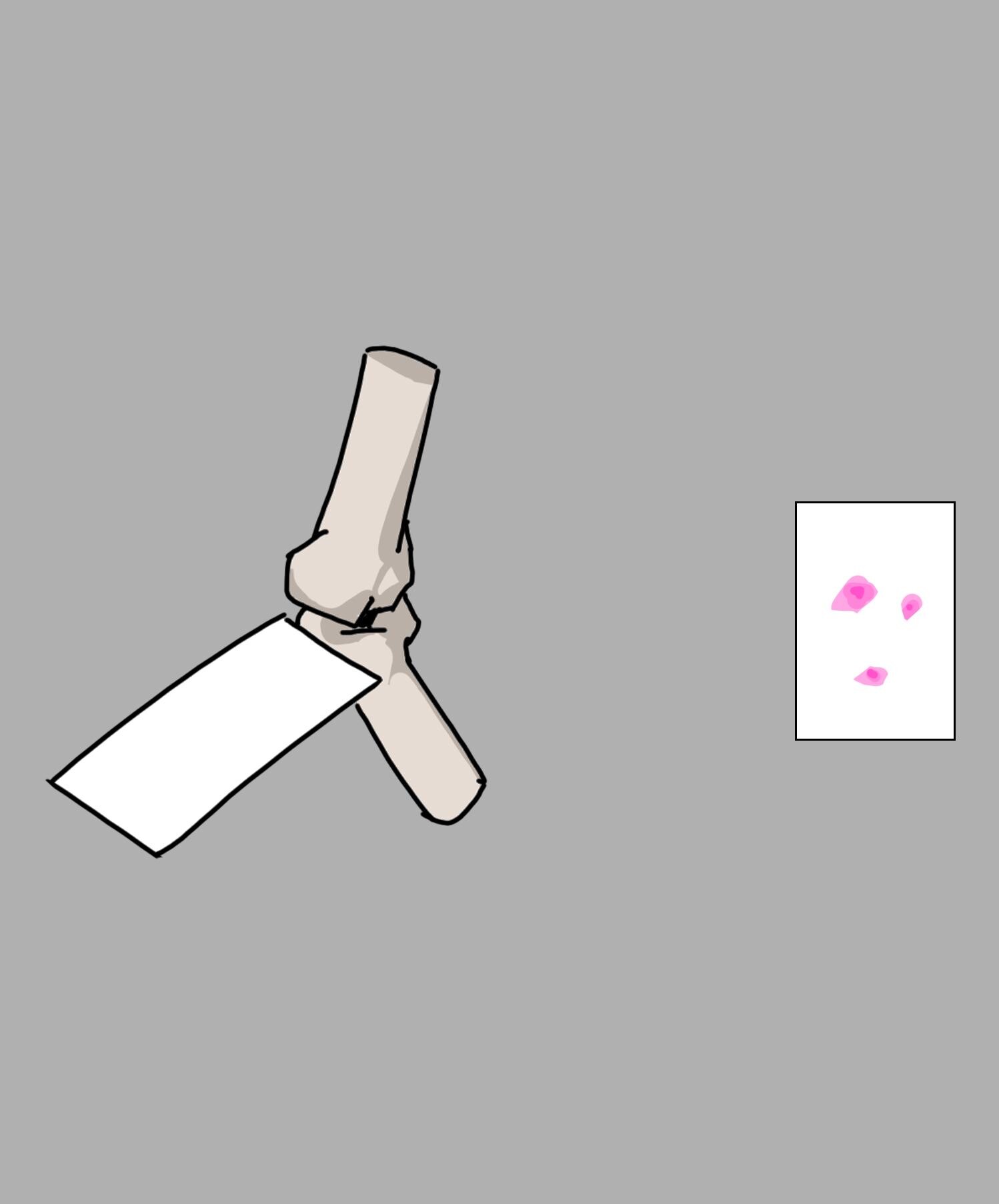 Orthopedic Application