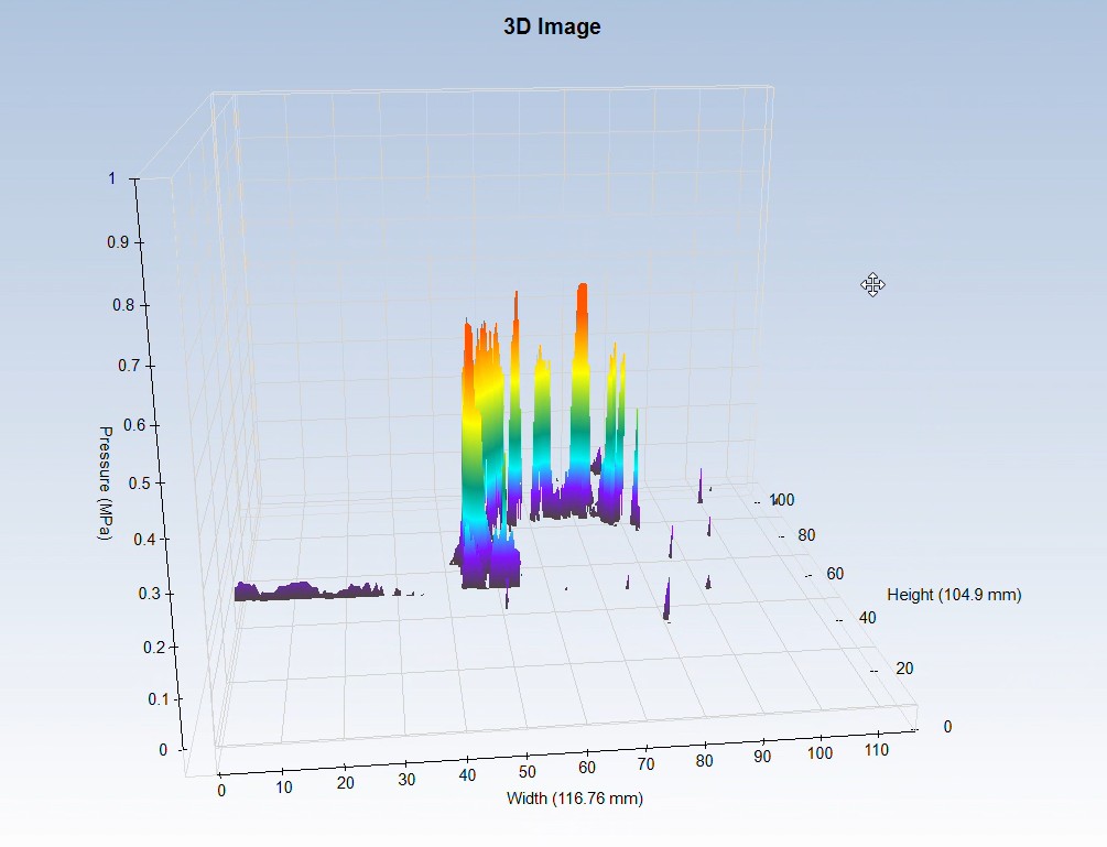 微信图片_2026-09-14_162455_171 From Morphology to Mechanics: How PF Pressure-Sensitive Paper Reconstructs Dental Occlusal Analysis