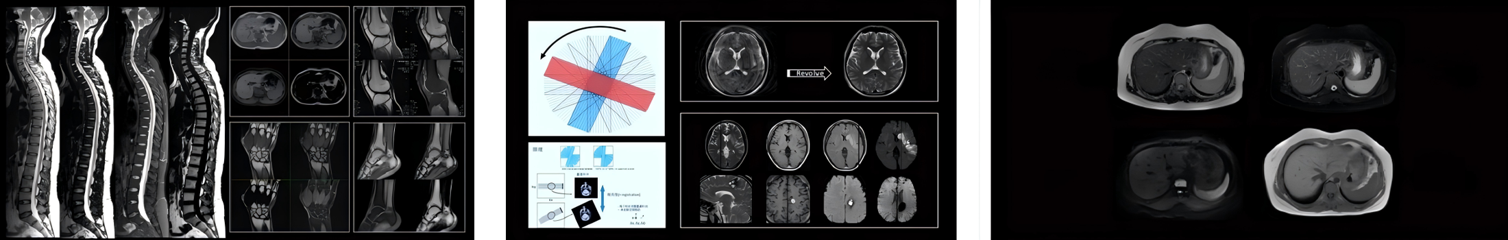 2EchoStar Comfort 1.5T